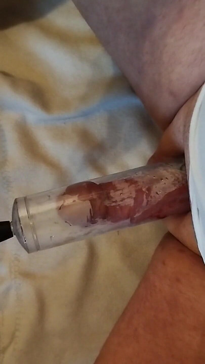 Penis Pump