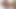 BBCのための飽くなきかゆみ