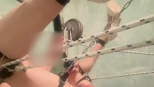 Banding no move anal