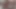 Lizzy Yum VR MAY 2023 JUST my PUSSY #3 post op orgasm pussy anal masturbation teasing orgasm and bathing