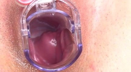 Gyneco hot