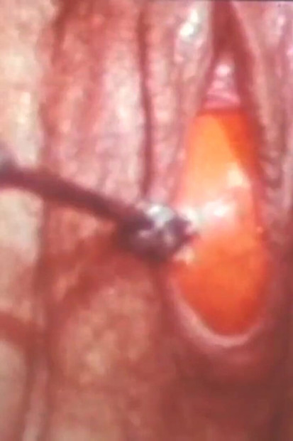 Vanessa i Marlene igraju se s jajima