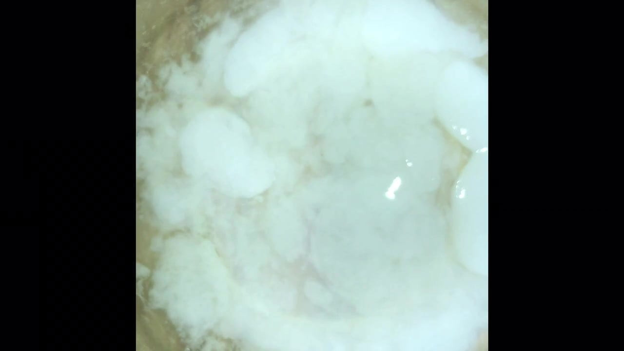 Semen Liquifaction