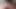 Foreskin Cumshot 539