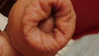 foreskin shower