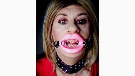 Lip gag and braces fetish featuring Alexandra Braces