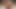 spatula handle in cock rotating swelling spreading urethra