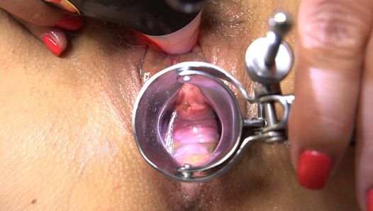 Doctor games! 1st Orgasm with a speculum in the cunt