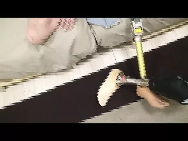 amputee dbk