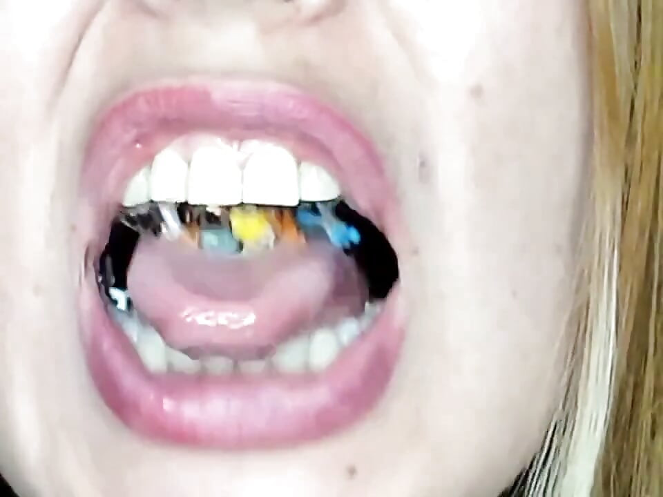 Ендоскопії!! Велетень проковтнула 25 членів одночасно