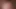 Marley Brinx facial