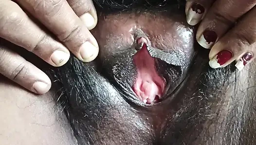 Ehefrau finger korche