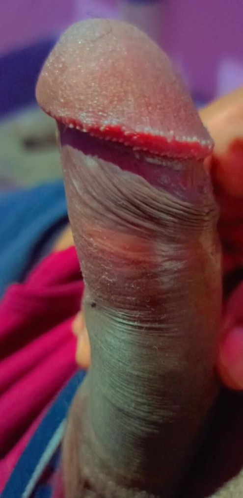 Hostel Boy Flashing Penis Hide Cramea