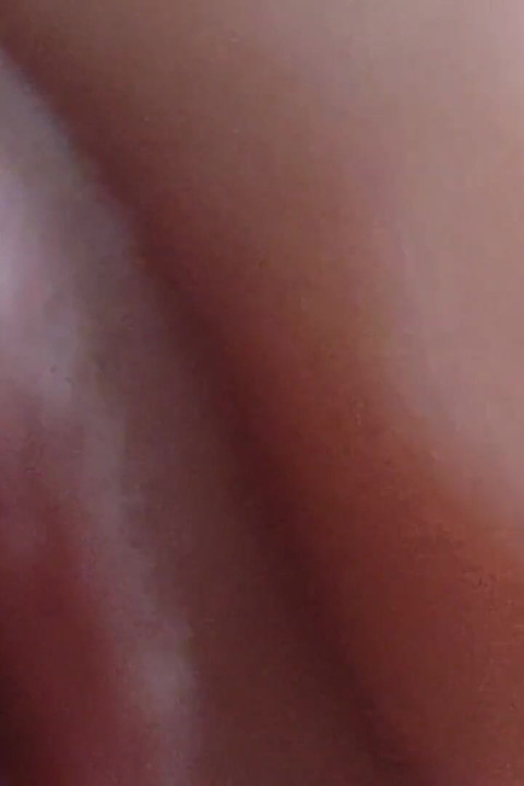 Scarred Frenulum Causes Glans Erection!