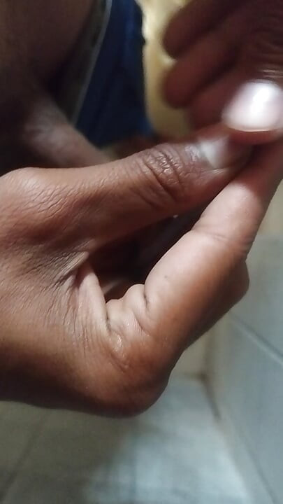 Vezivanje s kurčevim kuglicama