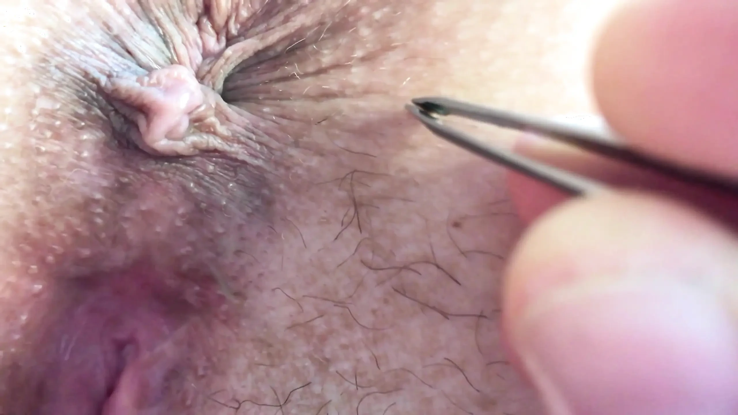 This is what happens when you ask your husband to help you remove the hair around the asshole and in the bikini area...