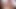 Lizzy Yum VR180+SD november 2023 electroshock #7 Post Op Orgasm Pussy masturbation teasing