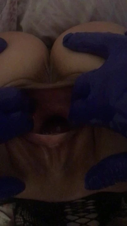 fisting 02