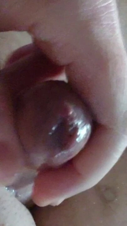 Foreskin precum massage to cum