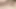 BBW with small dick with bladder catheter and swollen balls: he cums a lot!