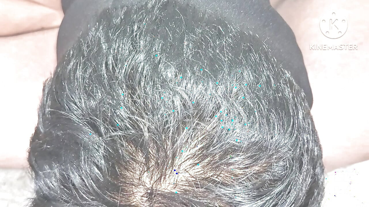Boyfriend removed his girlfriend hairy pussy to a clean pussy
