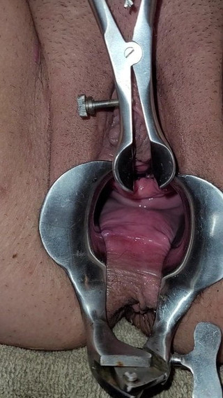 Speculum opening her peehole