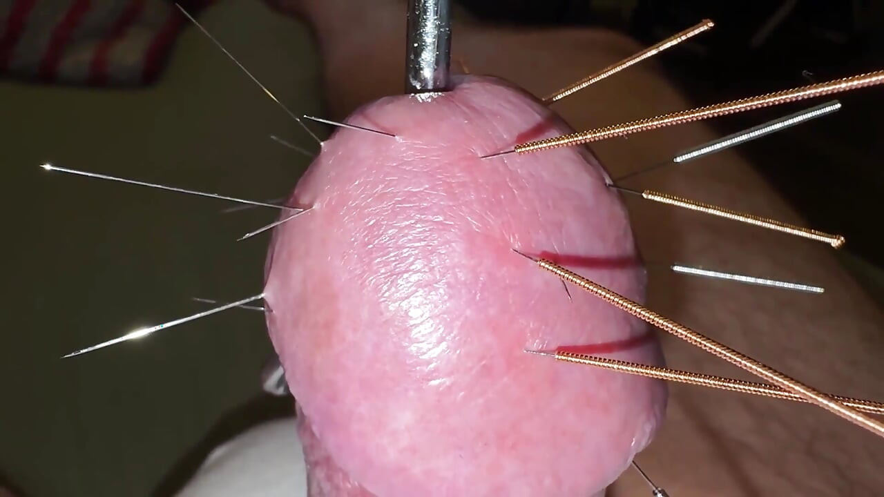 Acupuncture - Orgasm!