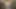 Hotkinkyjo in Gold Dress Take Double Anal Fisting From Alexthorn & Anal Prolapse in Studio