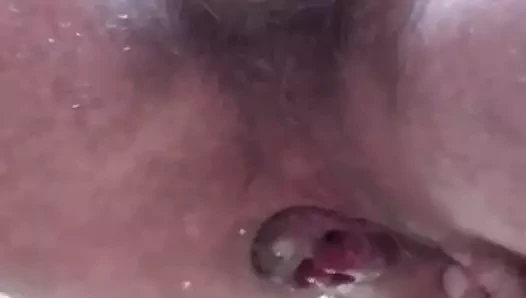 Une bonne dose.