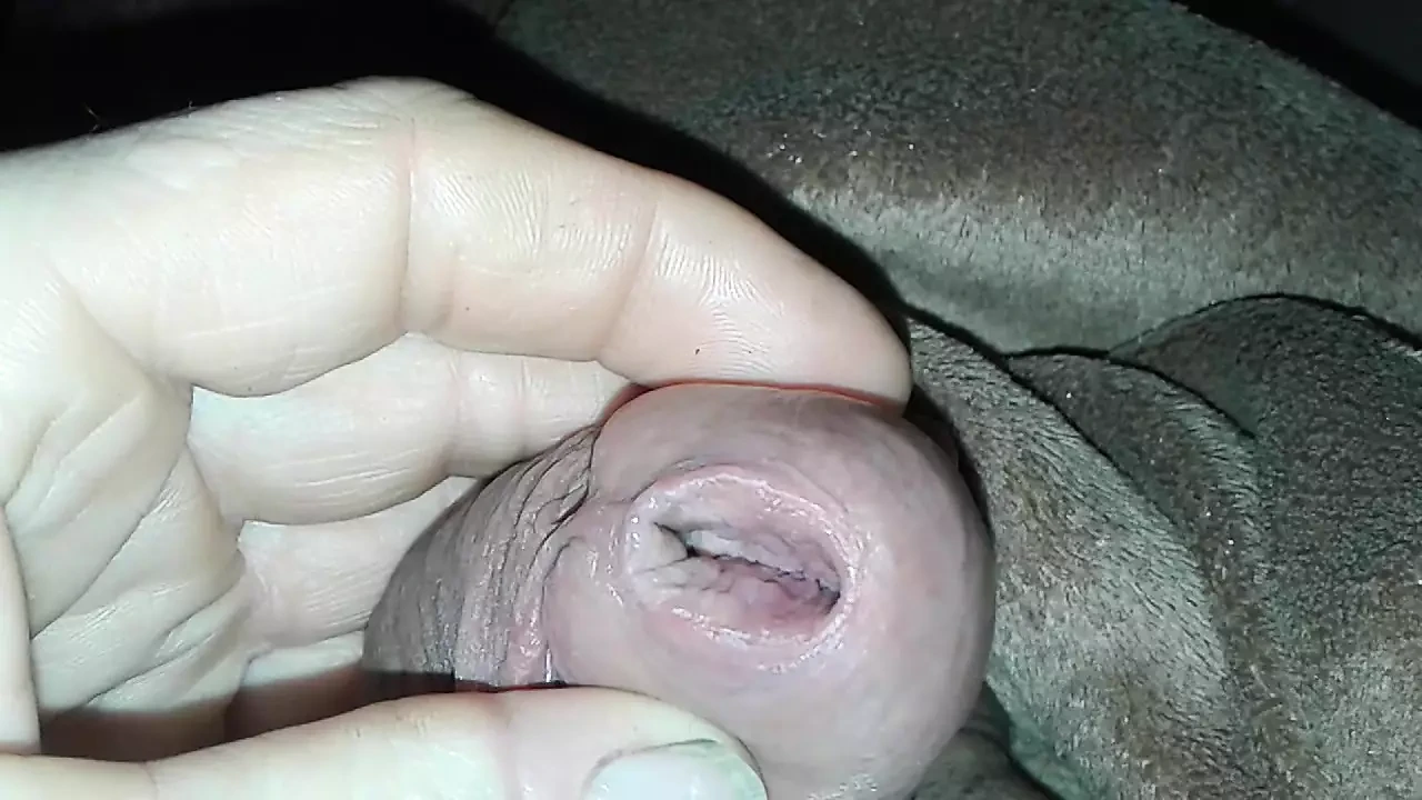 Heute mal den Daumen