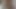 Lizzy Yum VR August 2025 Dilating #49