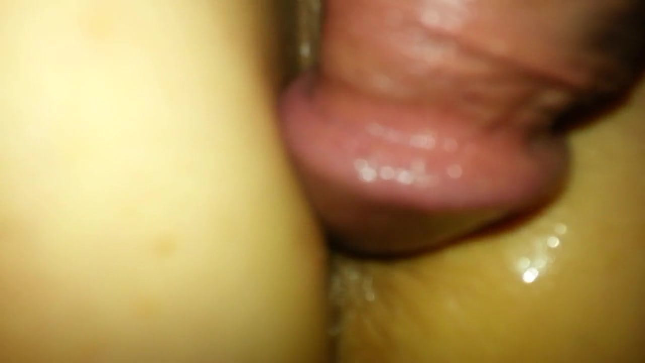 anal2