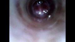 Olhe dentro do endoscópio do pau com tubo introduzindo a câmera profunda