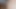 New Nursing College Girlfriend Fuck Hot Sex Video Big Black Cock Doggystyle Fuck