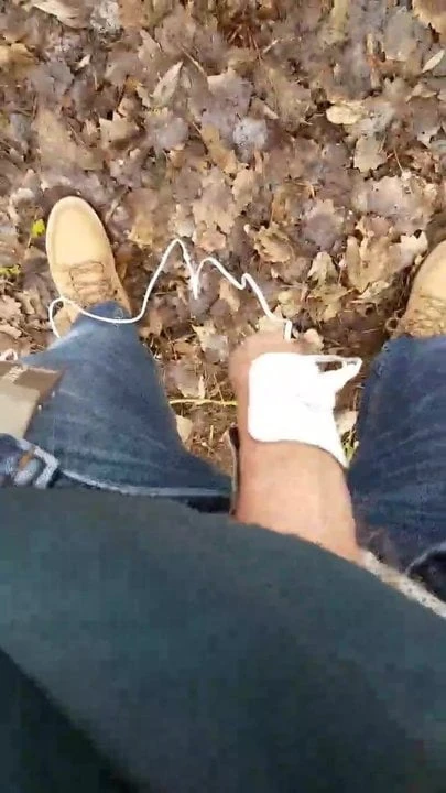 wood estim