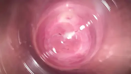 Kamera jauh di dalam vagina krim kecil Mia