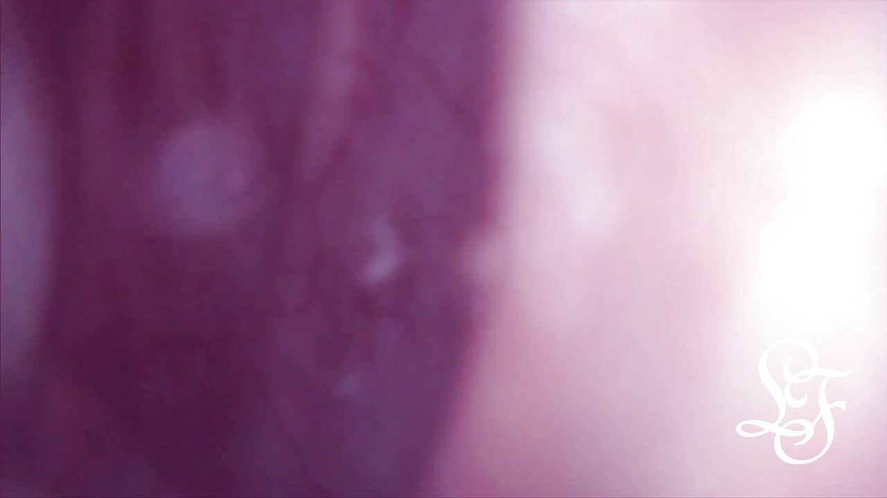 Bulge INSIDE my Bladder from Anal