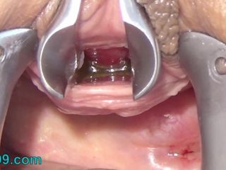 Мастурбирует уретра с зубной щеткой и цепью в уретру