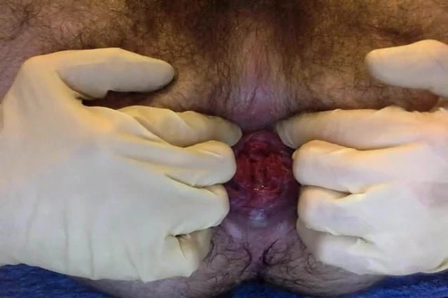 Anal Play 2