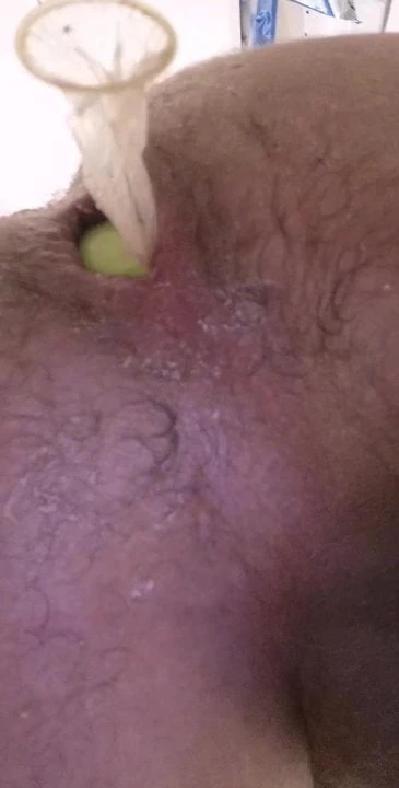 Peregangan anal