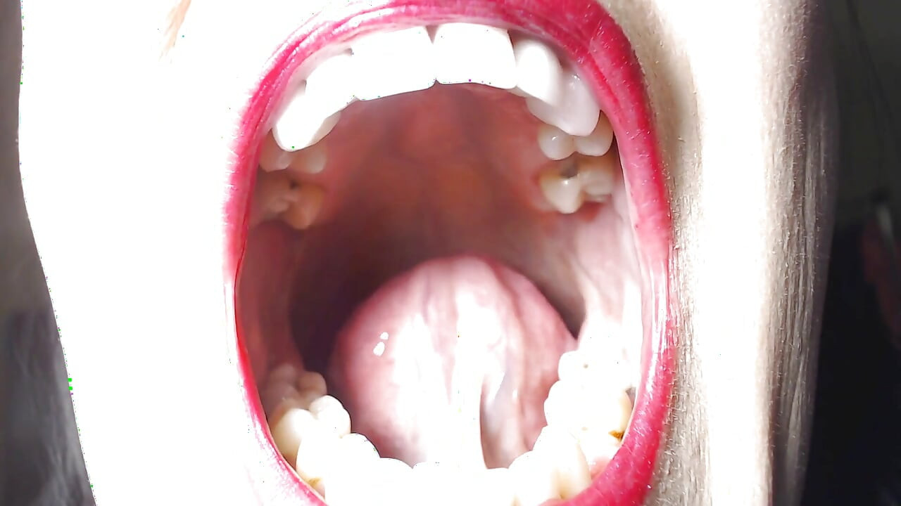 बड़ा चौड़ा खुला मुंह