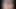 HD - Slowly Pulling Back My Foreskin (Smegma)