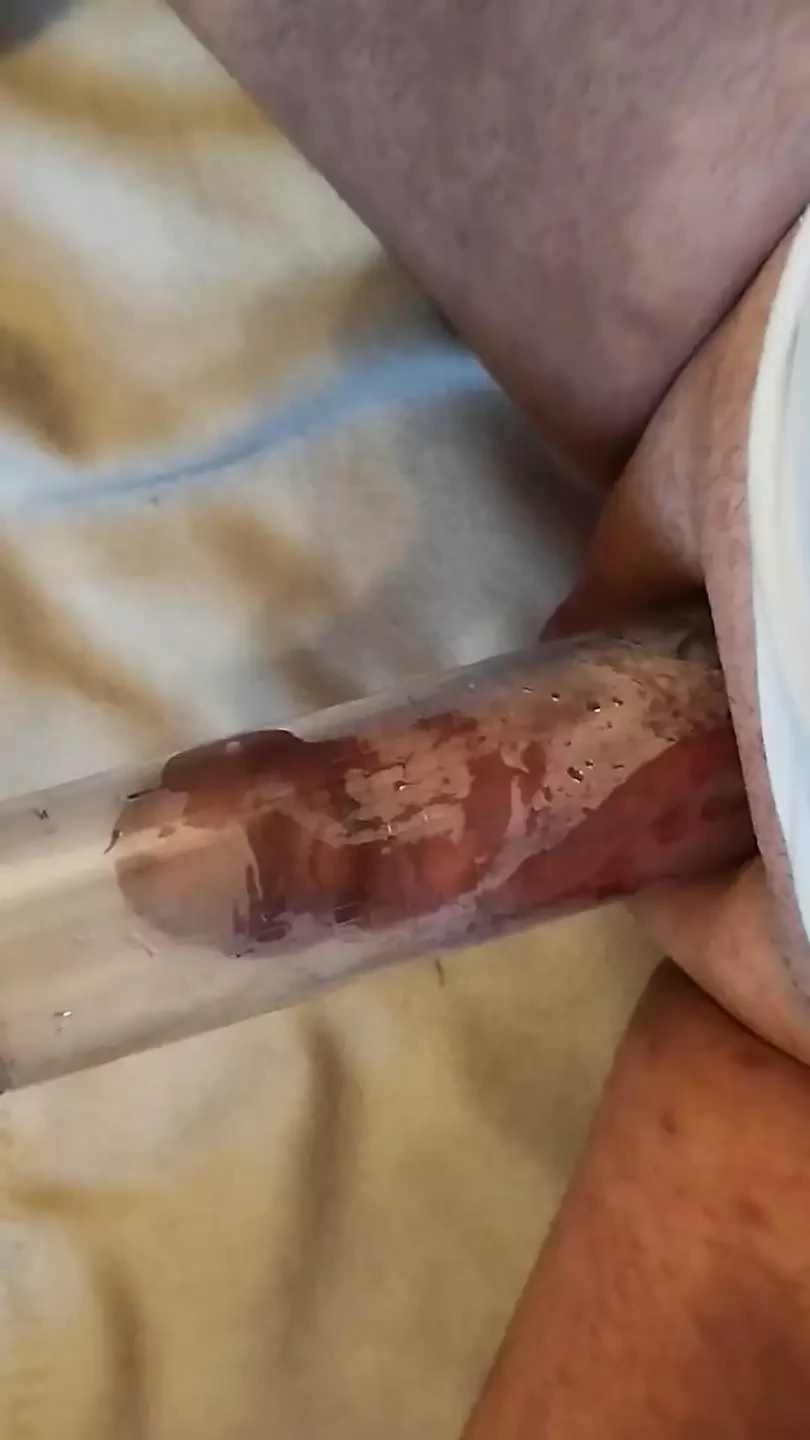 Penis Pump
