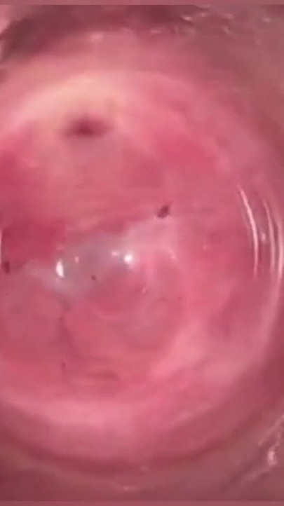 Câmera na vagina, colo do útero em primeiro plano, gozada interna | Clipe 1