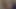 アンナ・カミングス・クイック・クリップ・ツー