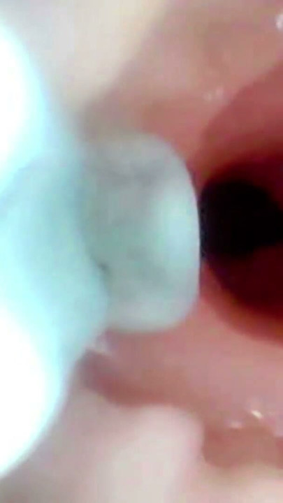 A detailed examination of Lopuza93 oral cavity and anal area using an endoscope camera. | Clip 1