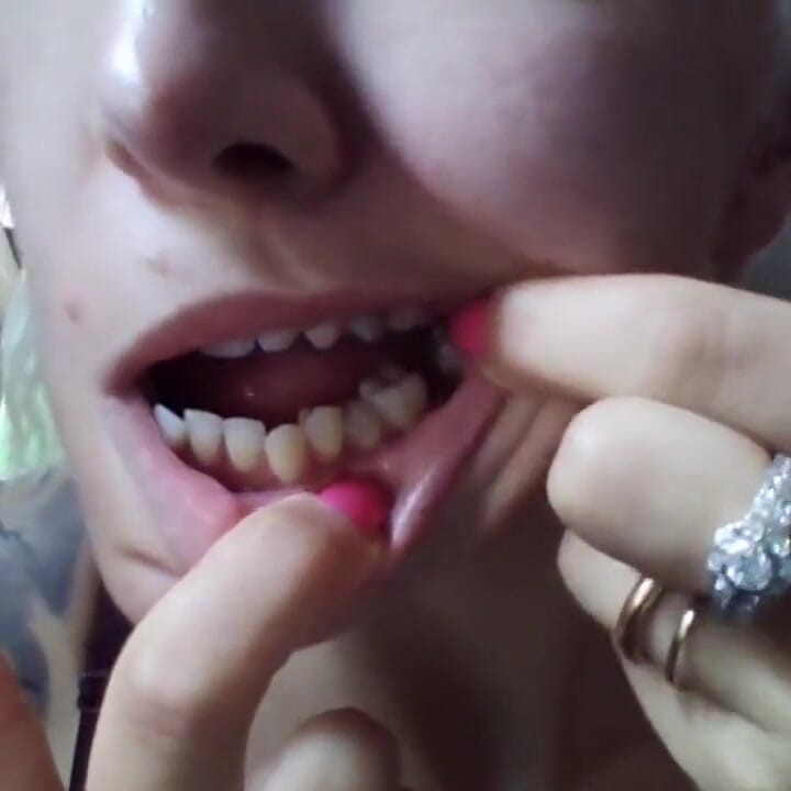 פנים יפות, אבל שיניים רקובות!