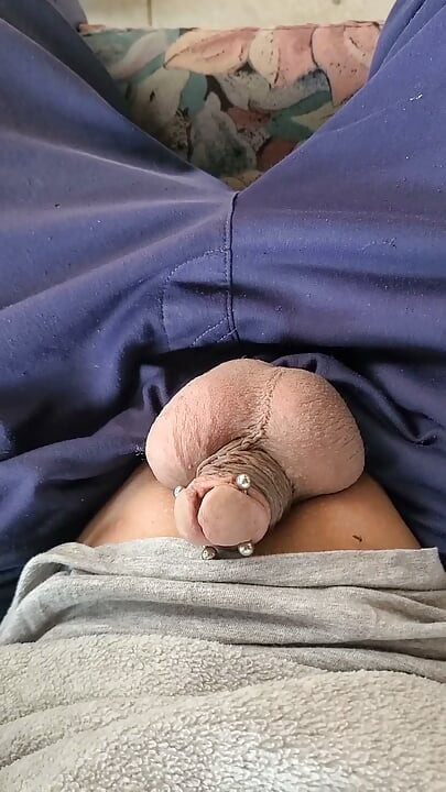 Dihisap nyamuk