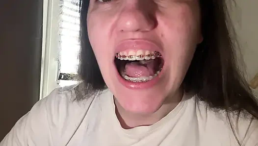 Licking Your Braces with Your Tongue