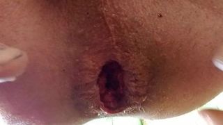 Gaping ass hole big gaped butthole fingers spread man pussy